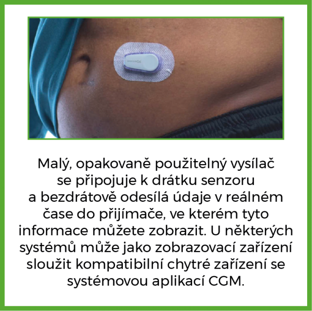 f98d7b94-dexcom-banner-jak-funguje-cgm-02.png